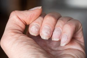 Secrets pour des ongles forts et sains : Astuces alimentaires essentielles